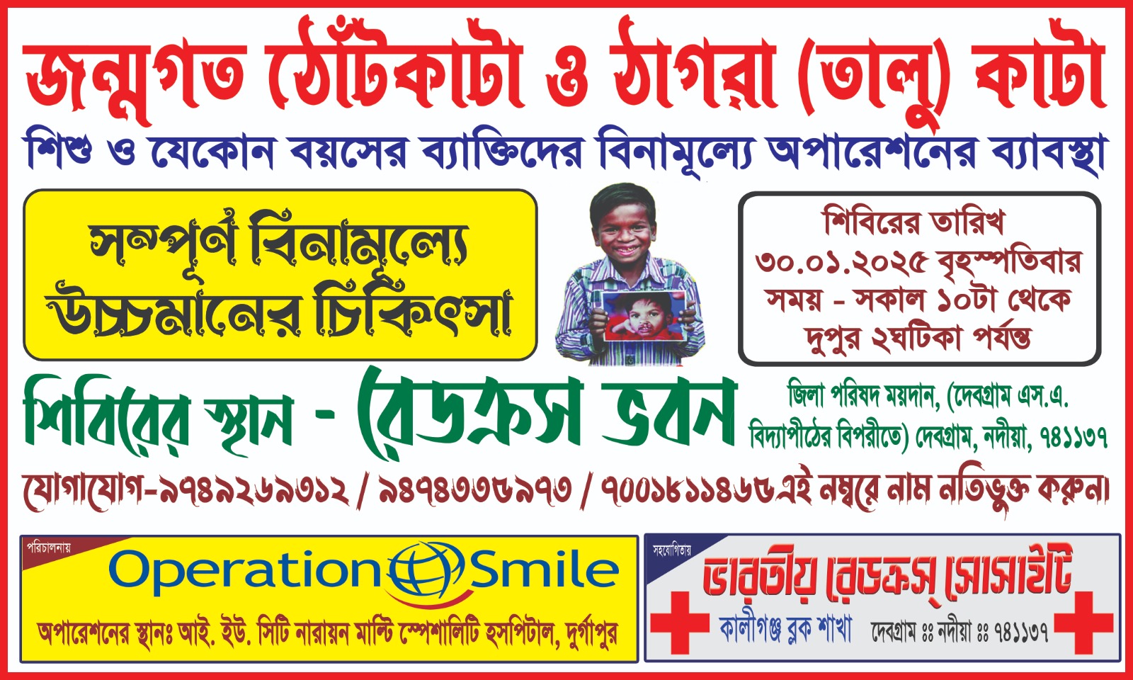 Operation Smile